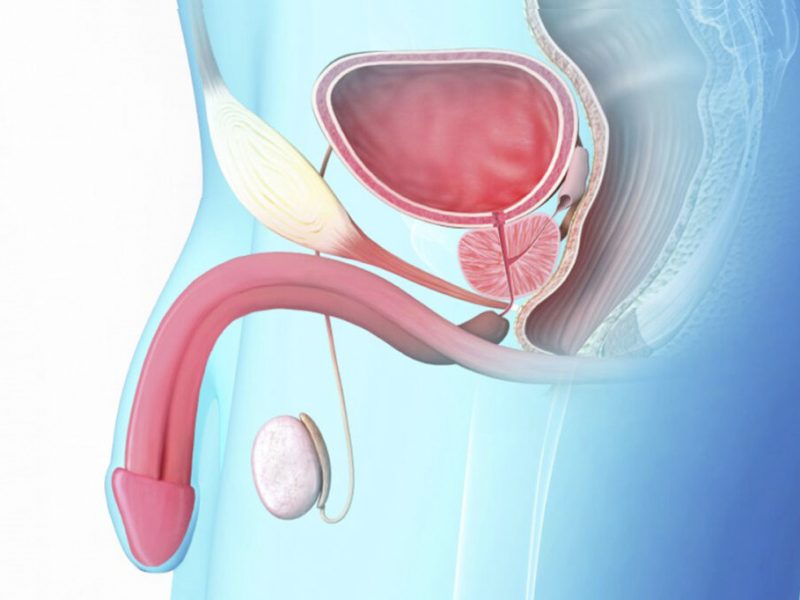 cancer-prostata